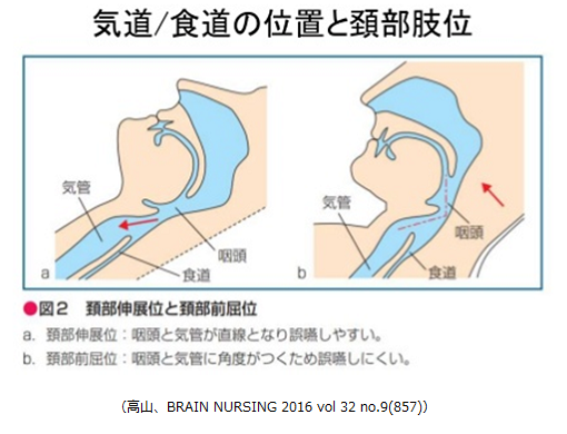 姿勢調節障害の理学療法 = Physical Therapy for Diso… 当日出荷対応品